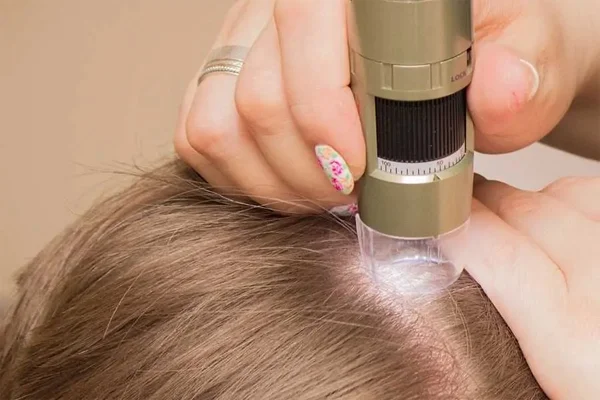 Masters In Trichology and Hair Transplant